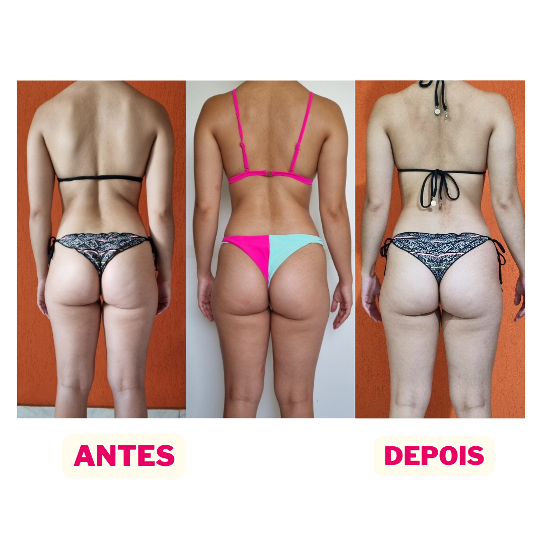 depois (5)