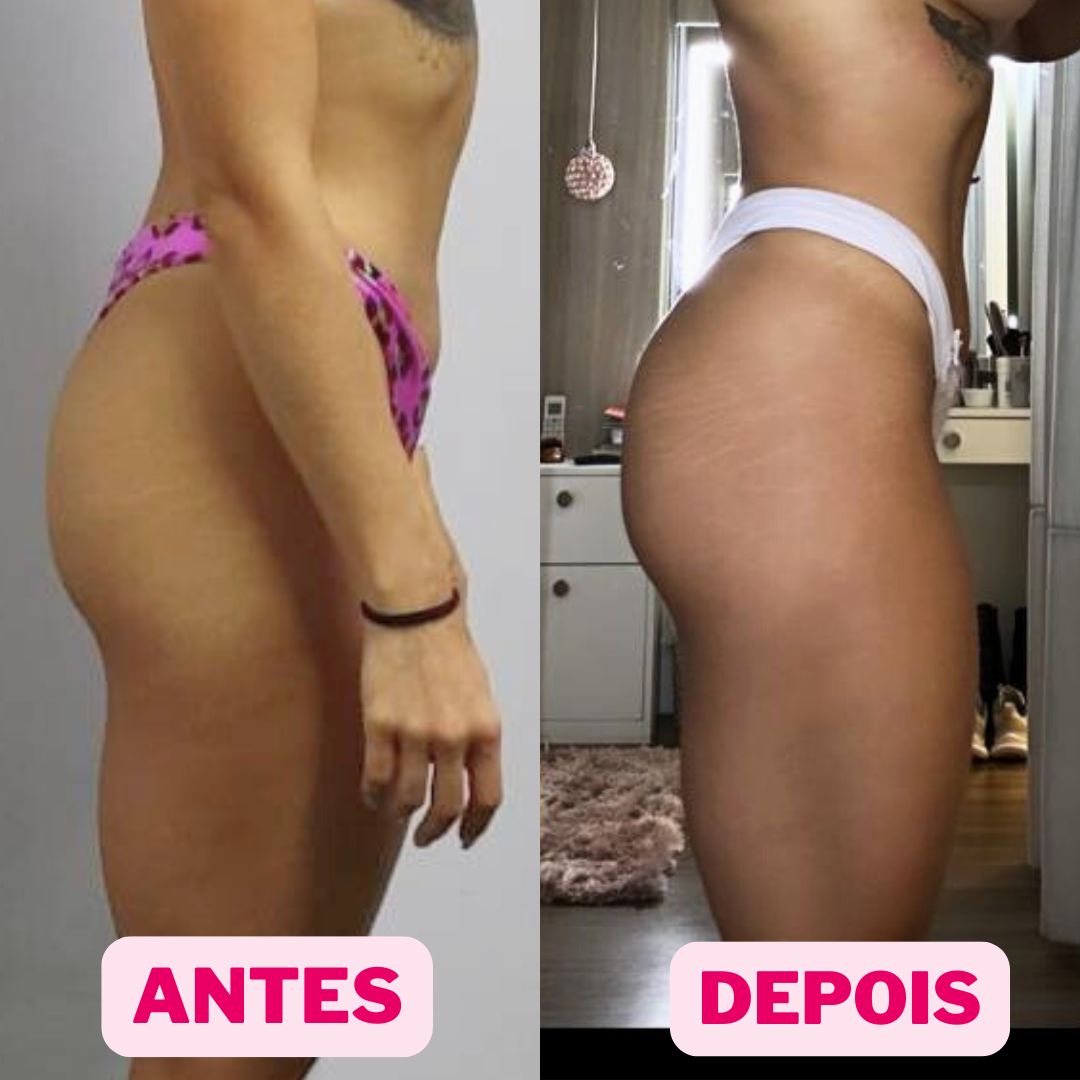 @viniciusdeandradee