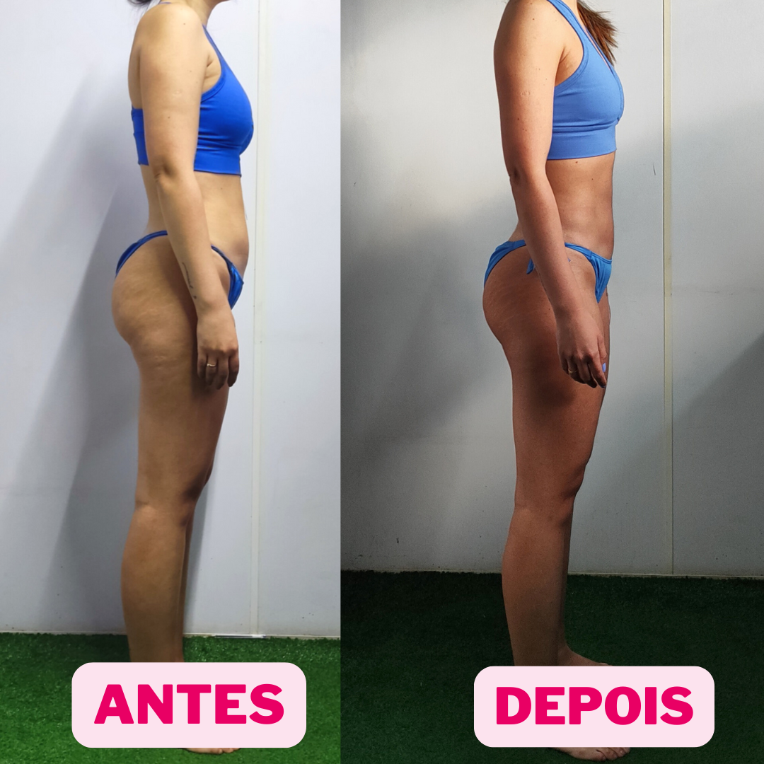 @viniciusdeandradee